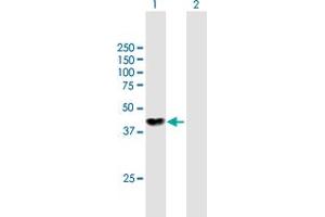 Image no. 1 for anti-Nucleoside Diphosphate Kinase (NME7) (AA 1-376) antibody (ABIN949243)