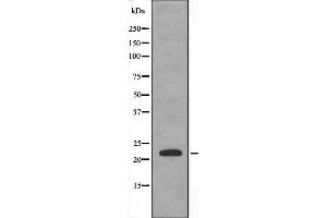 Image no. 3 for anti-Cysteine and Glycine-Rich Protein 1 (CSRP1) (Internal Region) antibody (ABIN6258036)