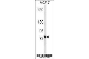 Image no. 1 for anti-ATP-Binding Cassette, Sub-Family B (MDR/TAP), Member 10 (ABCB10) (AA 1-27), (N-Term) antibody (ABIN652180)