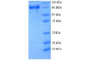 Image no. 1 for DnaJ (Hsp40) Homolog, Subfamily C, Member 10 (DNAJC10) (AA 1-656), (full length) protein (His tag) (ABIN5713678)