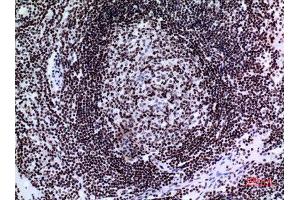 Image no. 5 for anti-Tumor Protein P73 (TP73) (Tyr221) antibody (ABIN3187855)