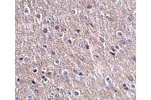 Image no. 2 for anti-LITAF-Like Protein (CDIP1) (Middle Region 1) antibody (ABIN1031187)