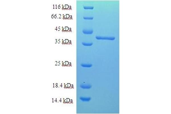 Chromosome 18 Open Reading Frame 10 (C18orf10) (AA 20-359) protein (His tag)