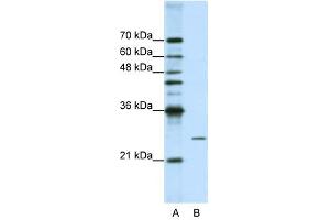 Image no. 2 for anti-Processing of Precursor 4, Ribonuclease P/MRP Subunit (POP4) antibody (ABIN629915)