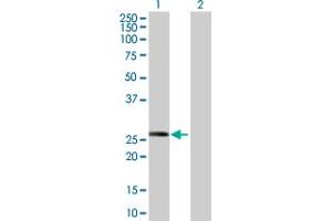 Image no. 1 for anti-Complement Factor H-Related 2 (CFHR2) (AA 19-270) antibody (ABIN516413)