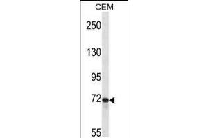 Image no. 1 for anti-Protein tyrosine Phosphatase, Receptor Type, E (PTPRE) (AA 134-163), (N-Term) antibody (ABIN5537769)