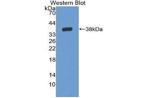 Image no. 1 for anti-Interleukin 6 Receptor (IL6R) (AA 19-348) antibody (ABIN1859440)