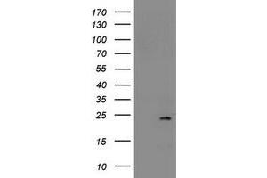 Image no. 2 for anti-NADH Dehydrogenase (Ubiquinone) 1 beta Subcomplex, 9, 22kDa (NDUFB9) (AA 3-179) antibody (ABIN1491361)