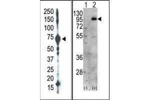 Image no. 1 for anti-Phosphatidylinositol-4-Phosphate 5-Kinase, Type I, gamma (PIP5K1C) (C-Term) antibody (ABIN360481)