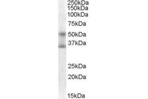 Image no. 2 for anti-Forkhead Box A1 (FOXA1) (C-Term) antibody (ABIN185021)