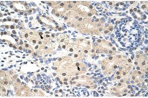 Image no. 3 for anti-Ring Finger Protein 14 (RNF14) (C-Term) antibody (ABIN2780586)