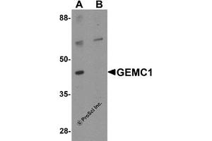 Image no. 2 for anti-Geminin Coiled-Coil Domain Containing (GMNC) (Middle Region) antibody (ABIN1030936)