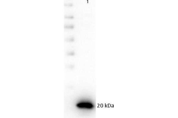 anti-Poly (ADP-Ribose) Polymerase 1 (PARP1) (C-Term) antibody