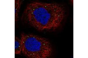 Image no. 1 for anti-Protein Associated with Topoisomerase II Homolog 1 (PATL1) antibody (ABIN5585266)