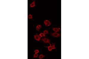 Image no. 1 for anti-Zinc Finger, DHHC-Type Containing 15 (ZDHHC15) (C-Term) antibody (ABIN6258553)