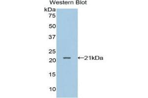 Image no. 1 for anti-Leukocyte Cell-Derived Chemotaxin 2 (LECT2) (AA 1-151) antibody (ABIN1859639)