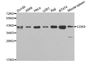 CDK9 抗体  (AA 153-372)