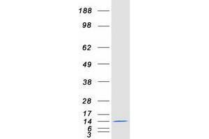 Urm1 Protein (Transcript Variant 1) (Myc-DYKDDDDK Tag)