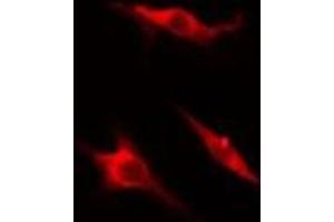 Image no. 1 for anti-Mitogen-Activated Protein Kinase 8 Interacting Protein 1 (MAPK8IP1) (pThr103) antibody (ABIN6256462)