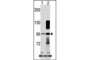 Western Blotting (WB) image for anti-Discoidin Domain Receptor tyrosine Kinase 2 (DDR2) antibody (ABIN2158508)