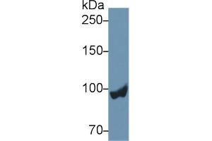 Western Blot; Sample: Rat Liver lysate; Primary Ab: 2µg/ml Rabbit Anti-Rat PYGL Antibody Second Ab: 0.