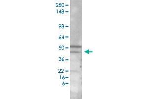 Image no. 1 for anti-Protein Interacting With Protein Kinase C, alpha 1 (PICK1) antibody (APC) (ABIN5585658)