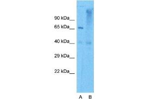 Image no. 6 for anti-Aconitase 1 (ACO1) (N-Term) antibody (ABIN2778793)