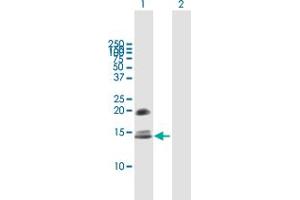 Image no. 1 for anti-Crumbs Homolog 3 (CRB3) (AA 1-120) antibody (ABIN530104)