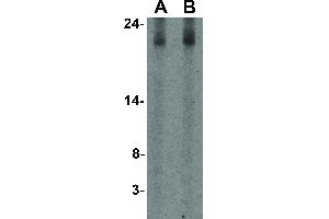 Image no. 1 for anti-Interleukin 17 (IL17) (Internal Region) antibody (ABIN6655742)