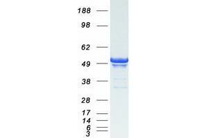 Image no. 1 for Perilipin 3 (PLIN3) protein (Myc-DYKDDDDK Tag) (ABIN2733776)