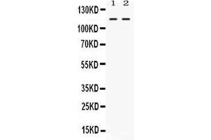 Image no. 1 for anti-Eukaryotic Translation Initiation Factor 2C, 4 (EIF2C4) (AA 114-153), (N-Term) antibody (ABIN4886439)