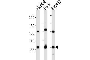 Image no. 7 for anti-Proprotein Convertase Subtilisin/kexin Type 9 (PCSK9) (AA 153-183), (N-Term) antibody (ABIN652320)