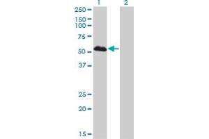 Image no. 3 for anti-Forkhead Box A1 (FOXA1) (AA 367-472) antibody (ABIN561299)