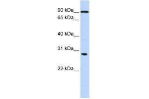 Image no. 1 for anti-Bol, Boule-Like (BOLL) antibody (ABIN633322)