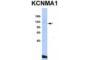Image no. 2 for anti-Potassium Large Conductance Calcium-Activated Channel, Subfamily M, alpha Member 1 (KCNMA1) (C-Term) antibody (ABIN2776143)