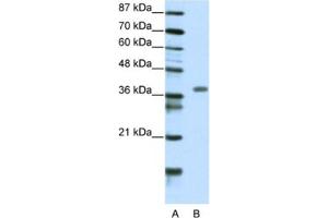 Image no. 1 for anti-Mesenchyme Homeobox 2 (MEOX2) antibody (ABIN2460538)