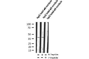 Image no. 4 for anti-Adrenergic, beta-2-, Receptor, Surface (ADRB2) (pSer346) antibody (ABIN6256279)
