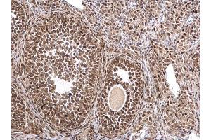 IHC-P Image MTA1 antibody [C1C3] detects MTA1 protein at nucleus on mouse ovary by immunohistochemical analysis.