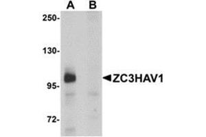 Image no. 2 for anti-Zinc Finger CCCH-Type, Antiviral 1 (ZC3HAV1) (C-Term) antibody (ABIN783641)