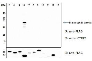 Image no. 1 for anti-C1q and Tumor Necrosis Factor Related Protein 5 (C1QTNF5) antibody (ABIN1169281)