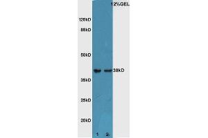 Lane 1:Mouse embryo lysate Lane 2:Mouse eye lysate probed with Rabbit Anti-ATF4/CREB-2 Polyclonal Antibody, Unconjugated  at 1:5000 for 90 min at 37˚C.