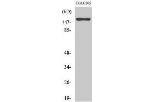 Image no. 1 for anti-Suppression of Tumorigenicity 5 (ST5) (Internal Region) antibody (ABIN3187070)