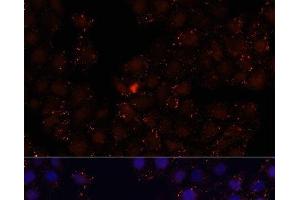 WDR81 antibody