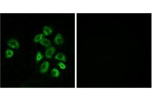 Image no. 2 for anti-G Protein-Coupled Receptor, Family C, Group 5, Member B (GPRC5B) (AA 61-110) antibody (ABIN1535728)