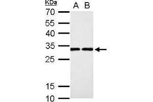 Image no. 2 for anti-Deoxycytidine Kinase (DCK) (Center) antibody (ABIN2855484)