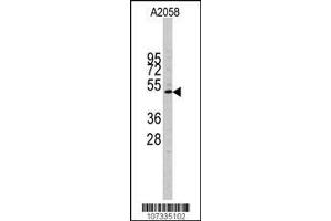 Image no. 1 for anti-Cyclin E1 (CCNE1) (AA 373-402), (C-Term) antibody (ABIN390209)