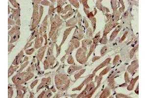 Immunohistochemistry of paraffin-embedded human heart tissue using ABIN7164781 at dilution of 1:100