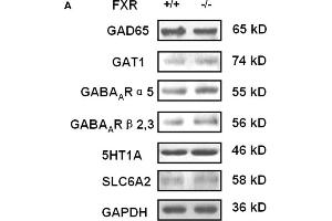 Image no. 5 for anti-Serotonin Receptor 1A (HTR1A) (Internal Region) antibody (ABIN2855909)