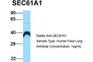 Image no. 2 for anti-Sec61 alpha 1 Subunit (SEC61A1) (C-Term) antibody (ABIN2790091)