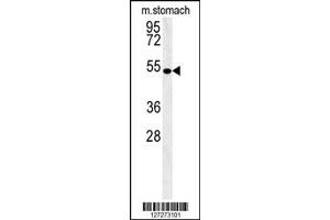Western Blotting (WB) image for anti-Coronin 6 (CORO6) antibody (ABIN2158333)